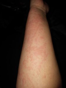 collection of hives4