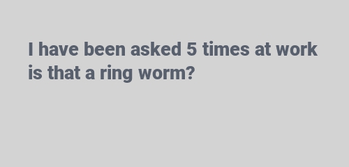 ring worm