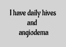 I have daily hives and angiodema