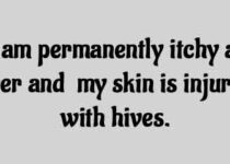 I am permanently itchy all over and my skin is injured with hives