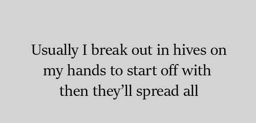 Usually I break out in hives on my hands to start off with then they’ll spread all