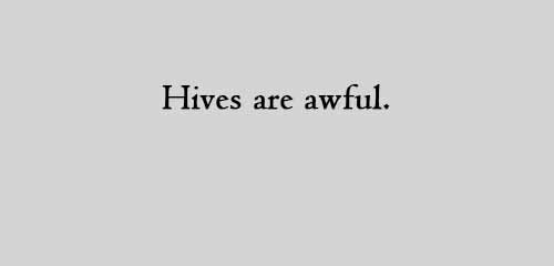 Hives are awful.